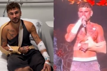 El cantante Dani Fernández se rompe los ligamentos de un hombro en un concierto en Valencia y acaba en el hospital