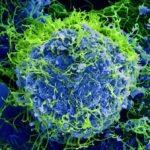 Ébola en el Congo: más de 9.800 contagios y 4.750 muertos en el peor brote de su historia